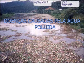 DOENÇAS CAUSADAS PELA ÁGUA
POLUIDA
 