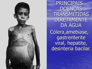 PRINCIPAIS
DOENÇAS
TRANSMITIDAS
DIRETAMENTE
DA ÁGUA
Cólera,amebíase,
gastrenterite
viral, hepatite,
desinteria bacilar.
 