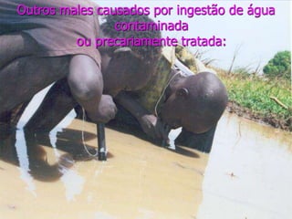 Outros males causados por ingestão de água
contaminada
ou precariamente tratada:
 