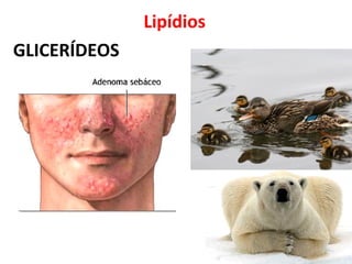 Lipídios
GLICERÍDEOS
 