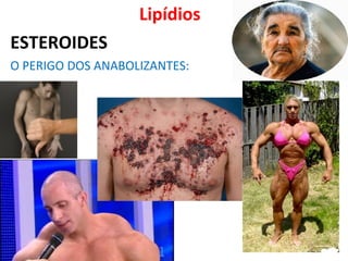 Lipídios
ESTEROIDES
O PERIGO DOS ANABOLIZANTES:
 