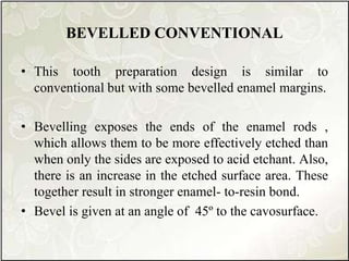 BEVELLED CONVENTIONAL
• This tooth preparation design is similar to
conventional but with some bevelled enamel margins.
• Bevelling exposes the ends of the enamel rods ,
which allows them to be more effectively etched than
when only the sides are exposed to acid etchant. Also,
there is an increase in the etched surface area. These
together result in stronger enamel- to-resin bond.
• Bevel is given at an angle of 45º to the cavosurface.
 