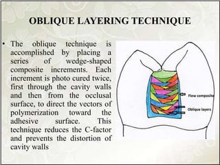 OBLIQUE LAYERING TECHNIQUE
• The oblique technique is
accomplished by placing a
series of wedge-shaped
composite increments. Each
increment is photo cured twice,
first through the cavity walls
and then from the occlusal
surface, to direct the vectors of
polymerization toward the
adhesive surface. This
technique reduces the C-factor
and prevents the distortion of
cavity walls
 