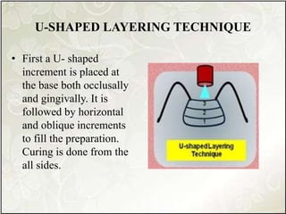 U-SHAPED LAYERING TECHNIQUE
• First a U- shaped
increment is placed at
the base both occlusally
and gingivally. It is
followed by horizontal
and oblique increments
to fill the preparation.
Curing is done from the
all sides.
 