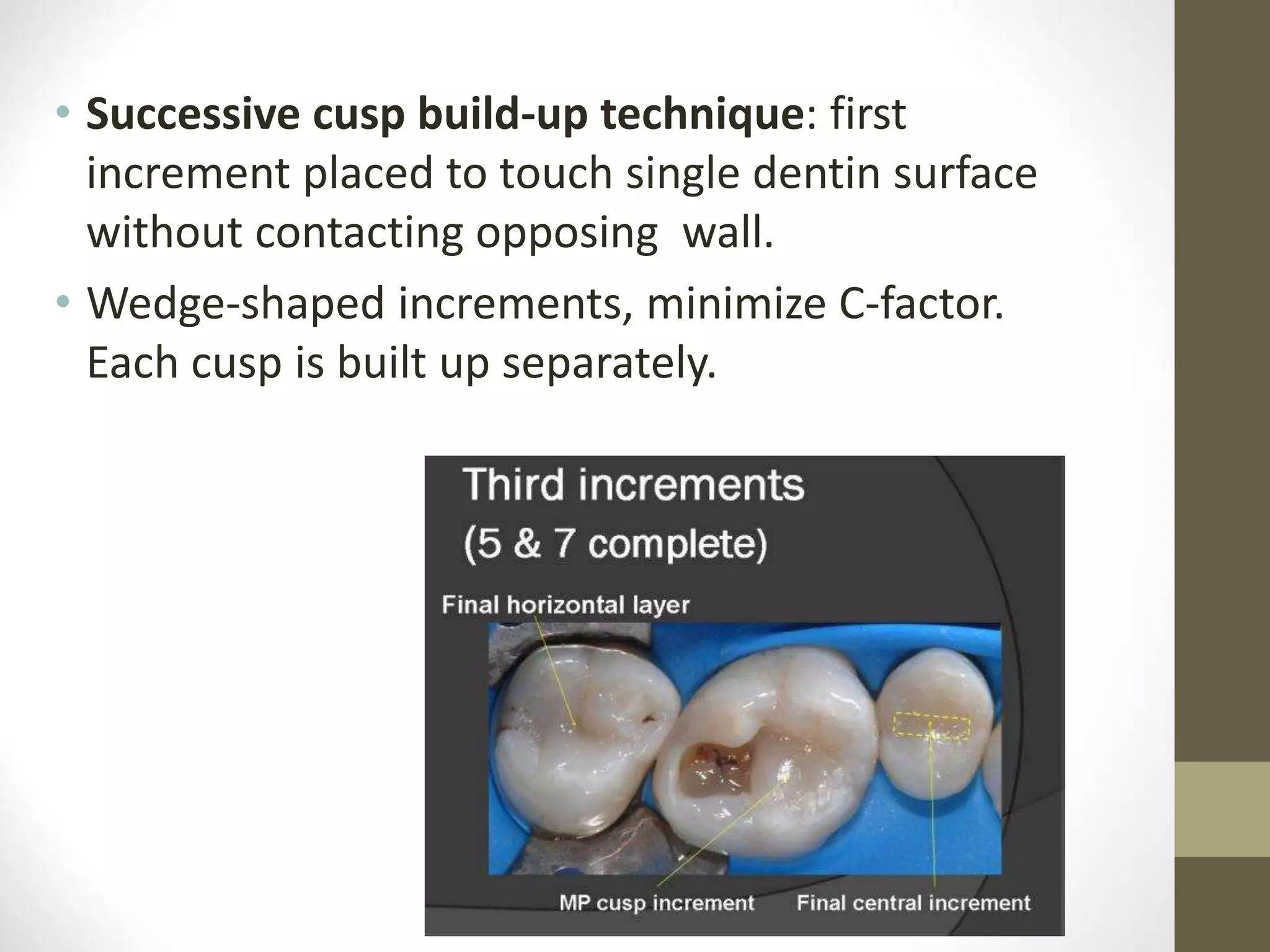 • Successive cusp build-up technique: first
increment placed to touch single dentin surface
without contacting opposing wall.
• Wedge-shaped increments, minimize C-factor.
Each cusp is built up separately.
 