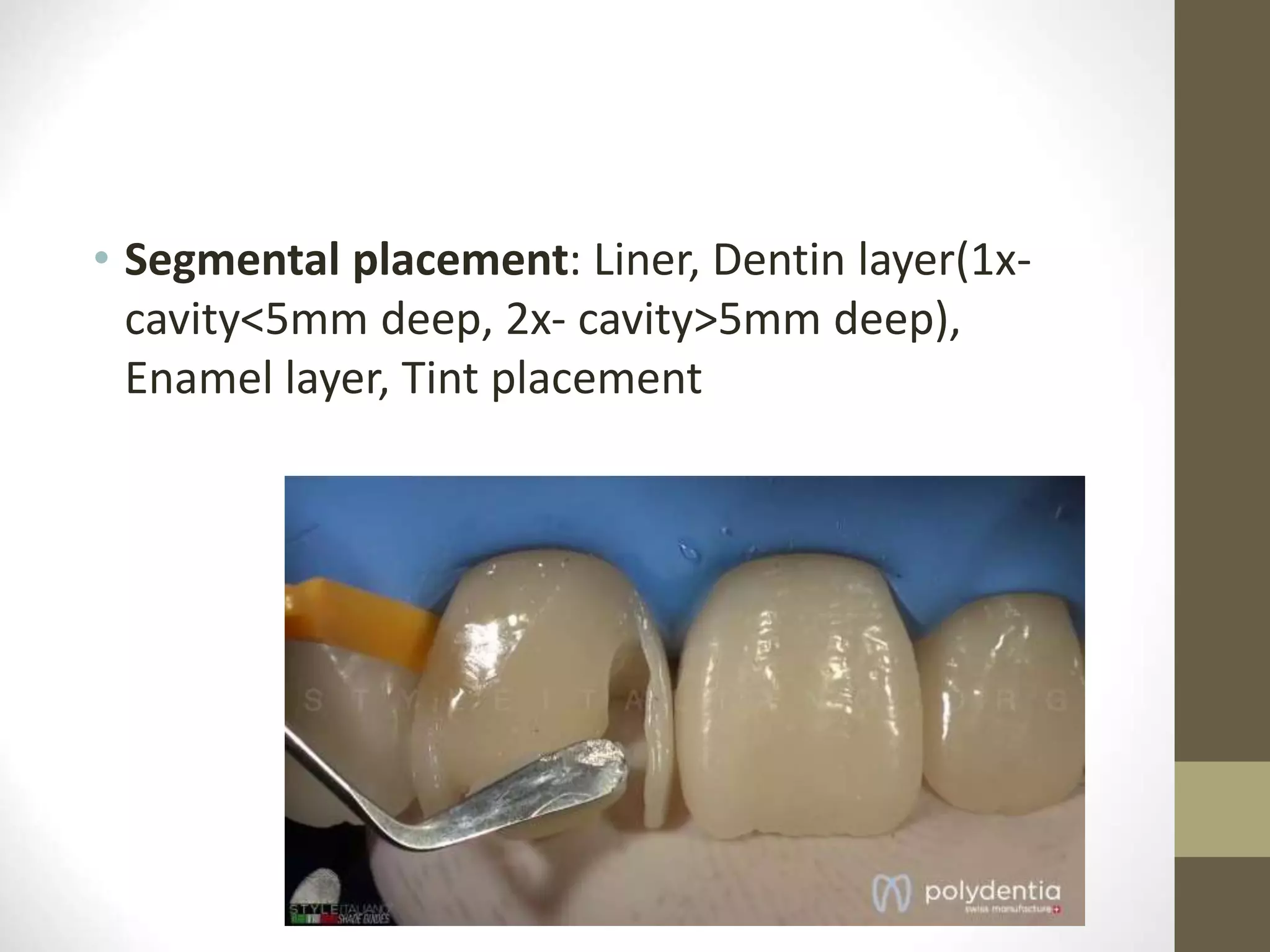 • Segmental placement: Liner, Dentin layer(1x-
cavity<5mm deep, 2x- cavity>5mm deep),
Enamel layer, Tint placement
 