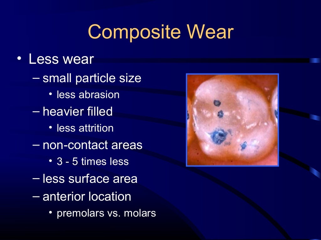 Composite and acid etching