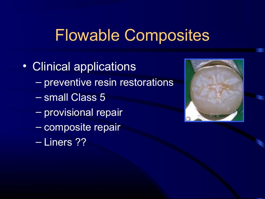 Composite and acid etching