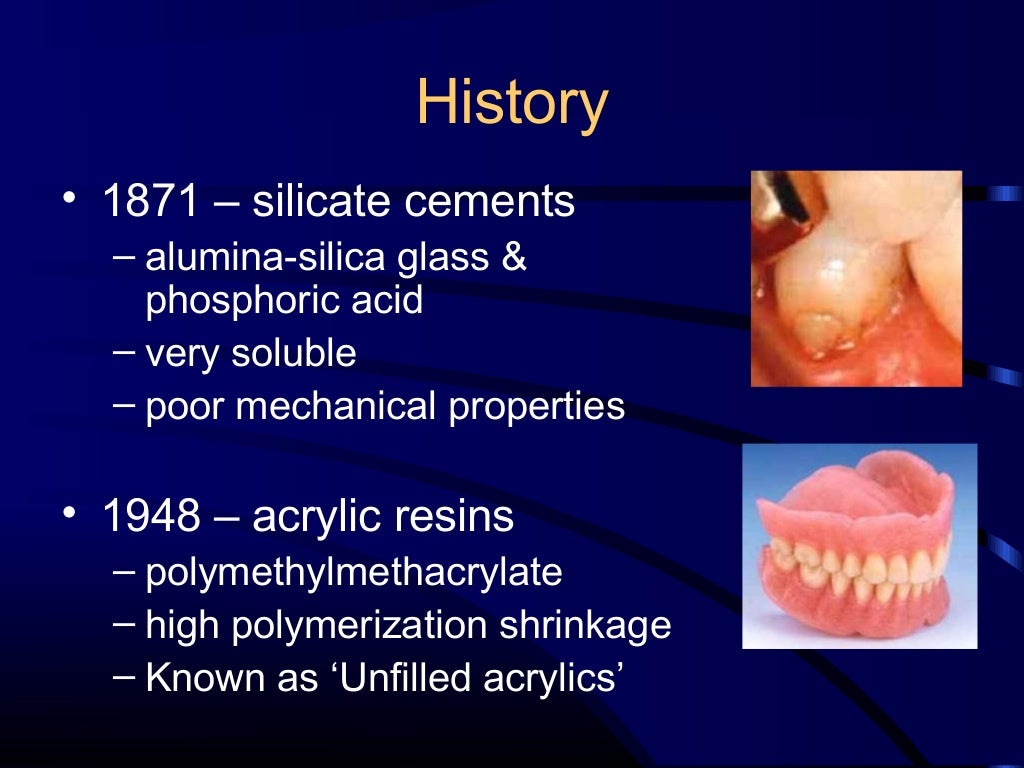 Composite and acid etching