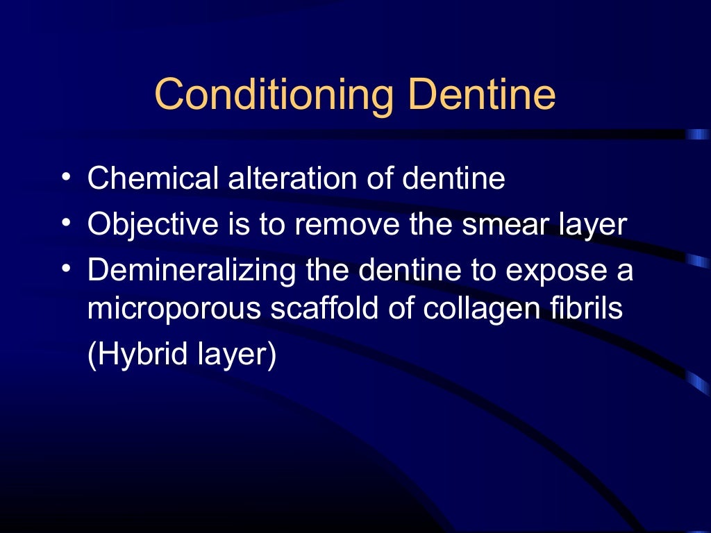 Composite and acid etching