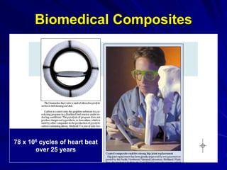 Biomedical Composites
s
75X106 cyles of heart beat
78 x 106 cycles of heart beat
over 25 years
 