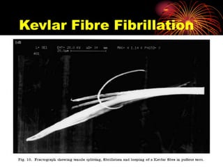 149
Kevlar Fibre Fibrillation
 