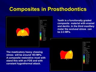 Composites in Prosthodontics
Tooth is a functionally graded
composite material with enamel
and dentin. In the third maxillary
molar the occlusal stress can
be 2-3 MPa.
The masticatory heavy chewing
stress will be around 193 MPa.
A composite restorative must with
stand this with an FOS and with
constant hygrothermal attack.
 