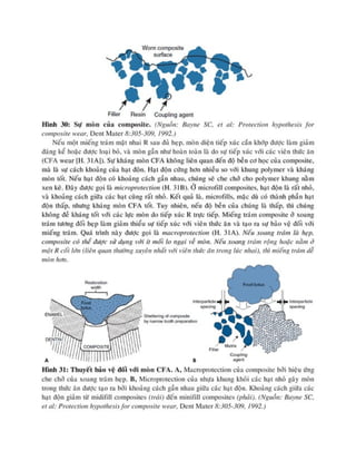 composite nha khoa.pdf