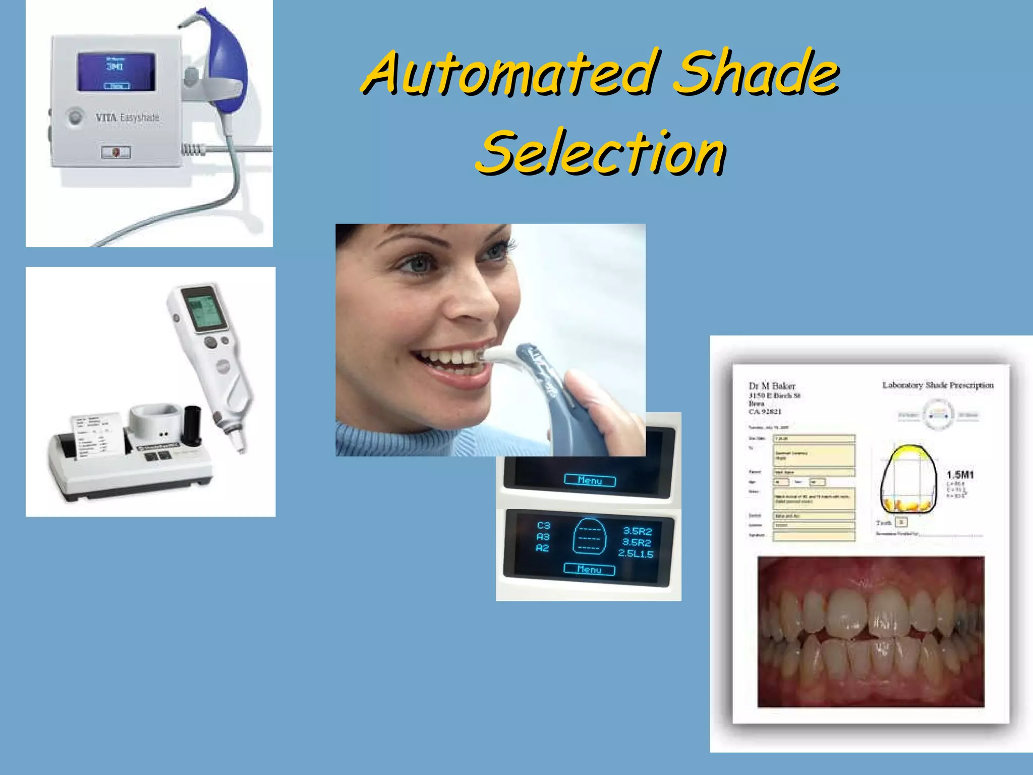 Automated Shade Selection 