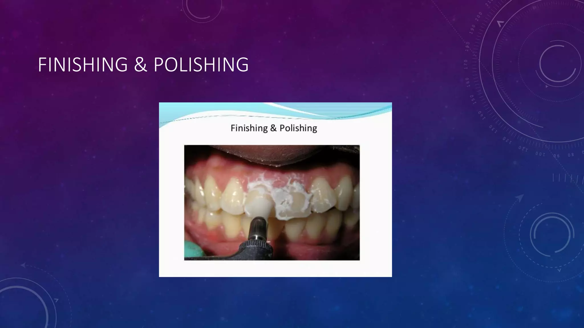 FINISHING & POLISHING
 