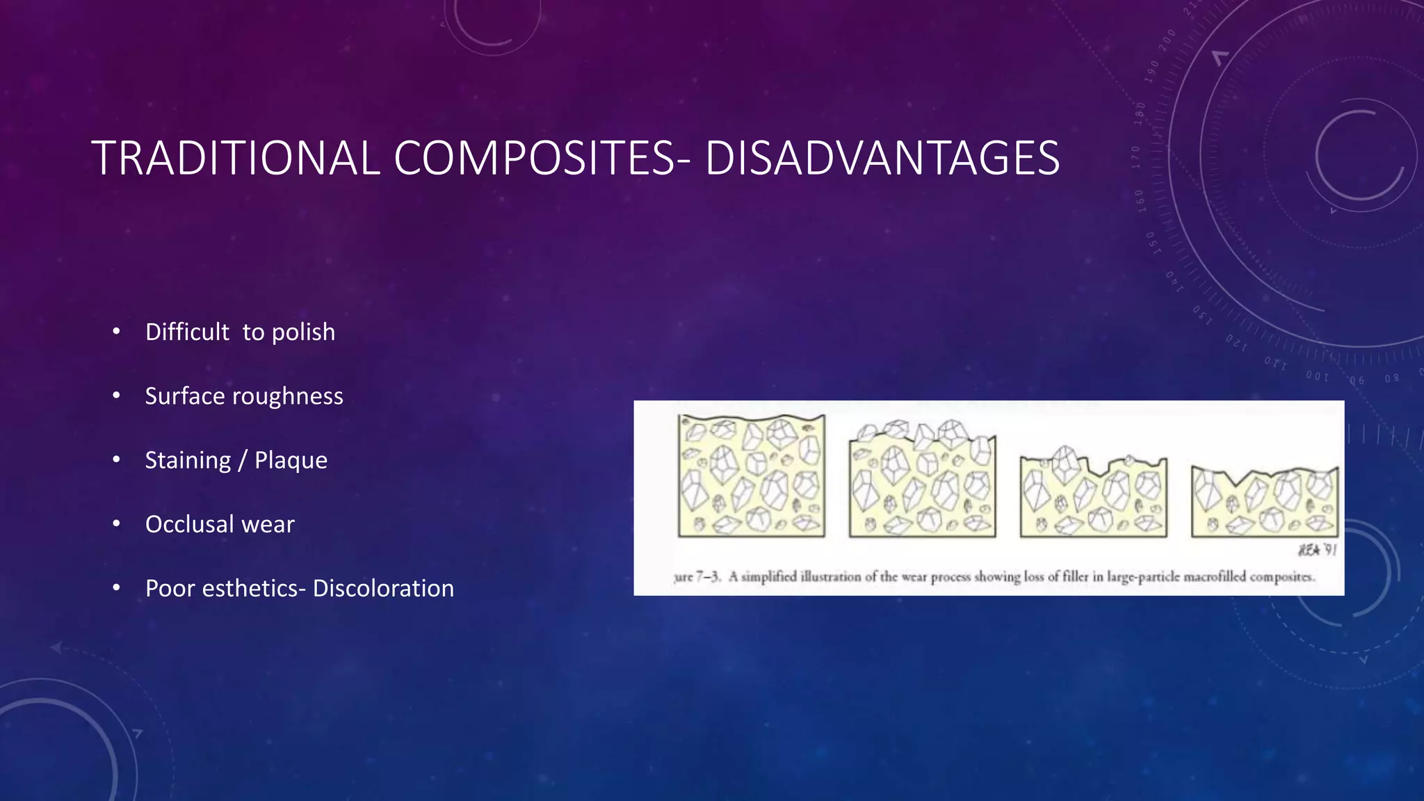 TRADITIONAL COMPOSITES- DISADVANTAGES
• Difficult to polish
• Surface roughness
• Staining / Plaque
• Occlusal wear
• Poor esthetics- Discoloration
 
