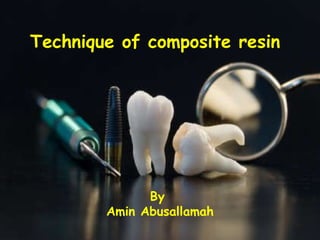 Technique of composite resin  By  Amin Abusallamah 