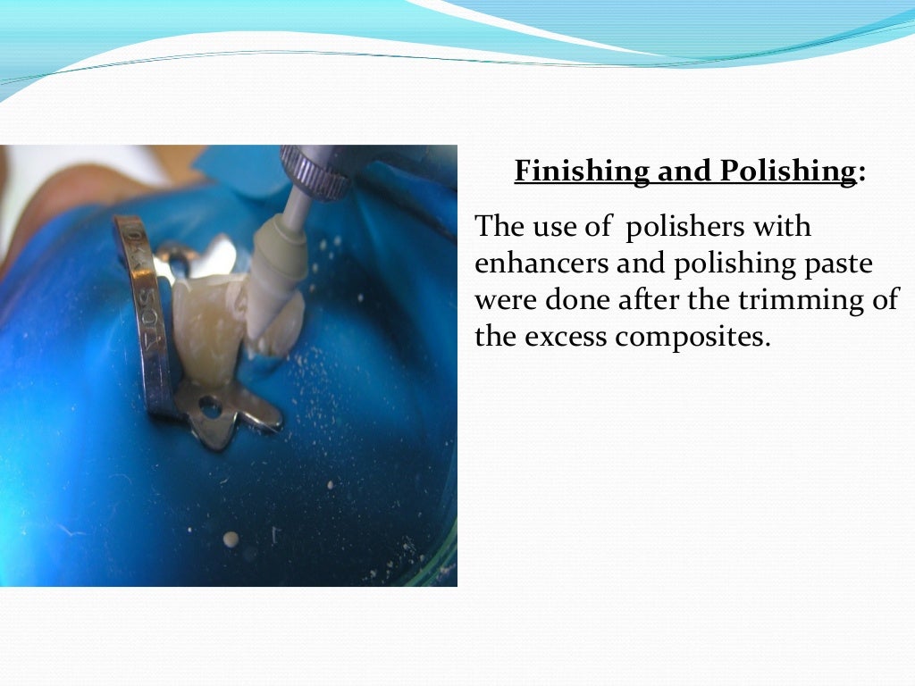 Composite restoration