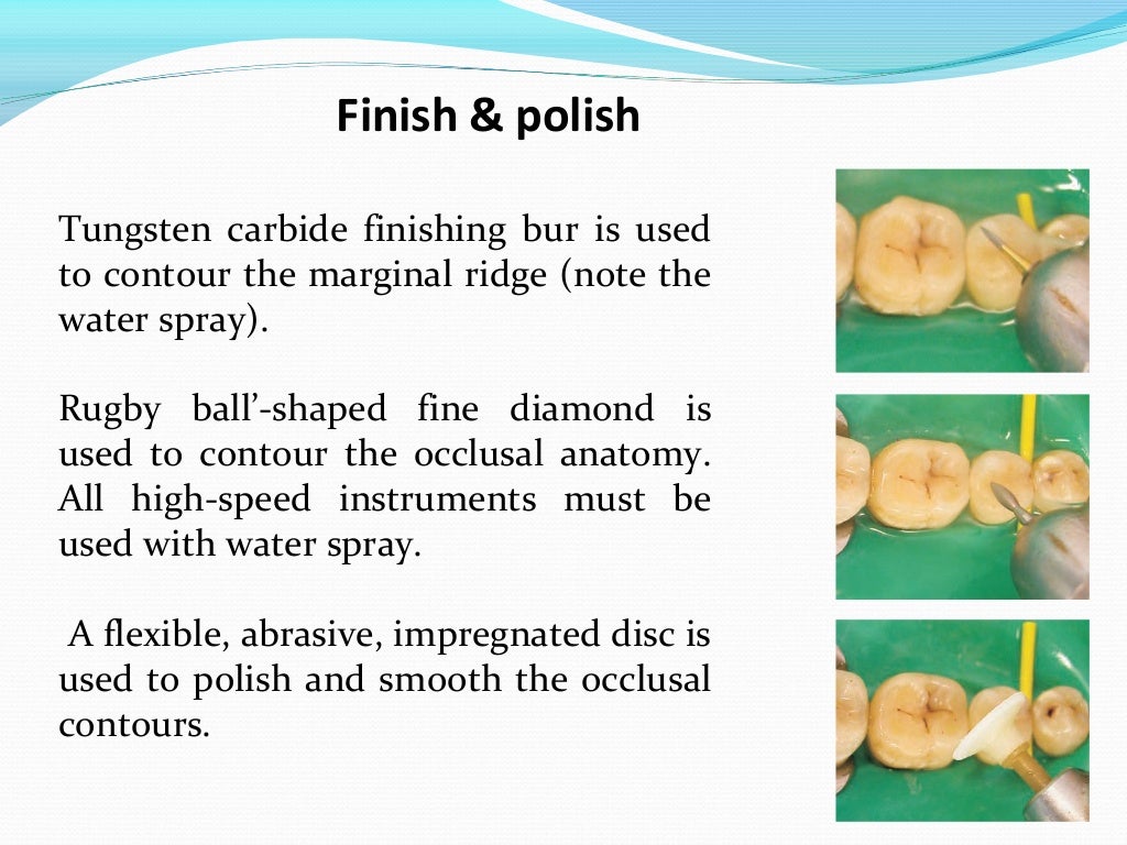 Composite restoration