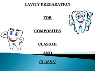 CAVITY PREPARATION
FOR
COMPOSITES
CLASS III
AND
CLASS V
 