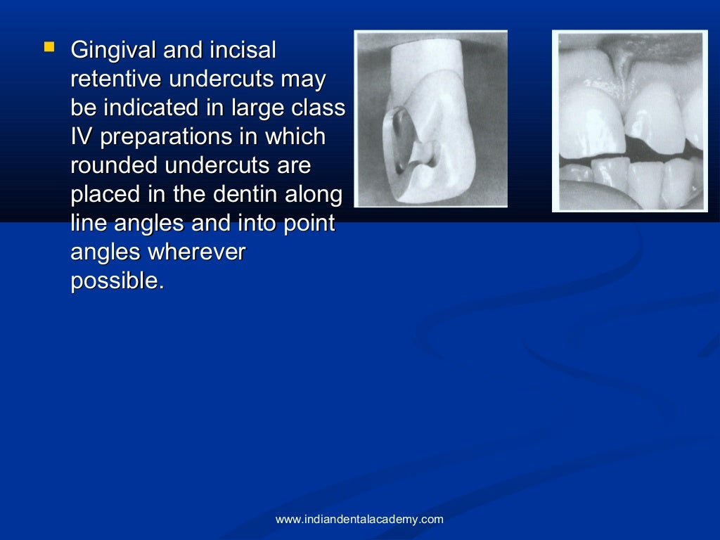 Composites / dental implant courses