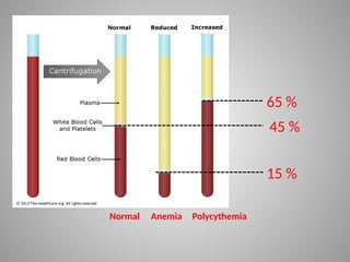 45 %
Anemia Polycythemia
Normal
15 %
65 %
 