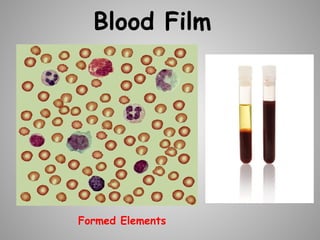 Blood Film
Formed Elements
 