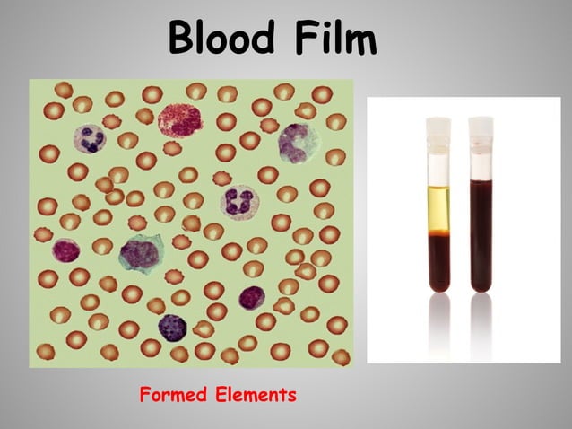 BLOOD COMPOSITION COMPONENTS AND FUNCTION visual data 7