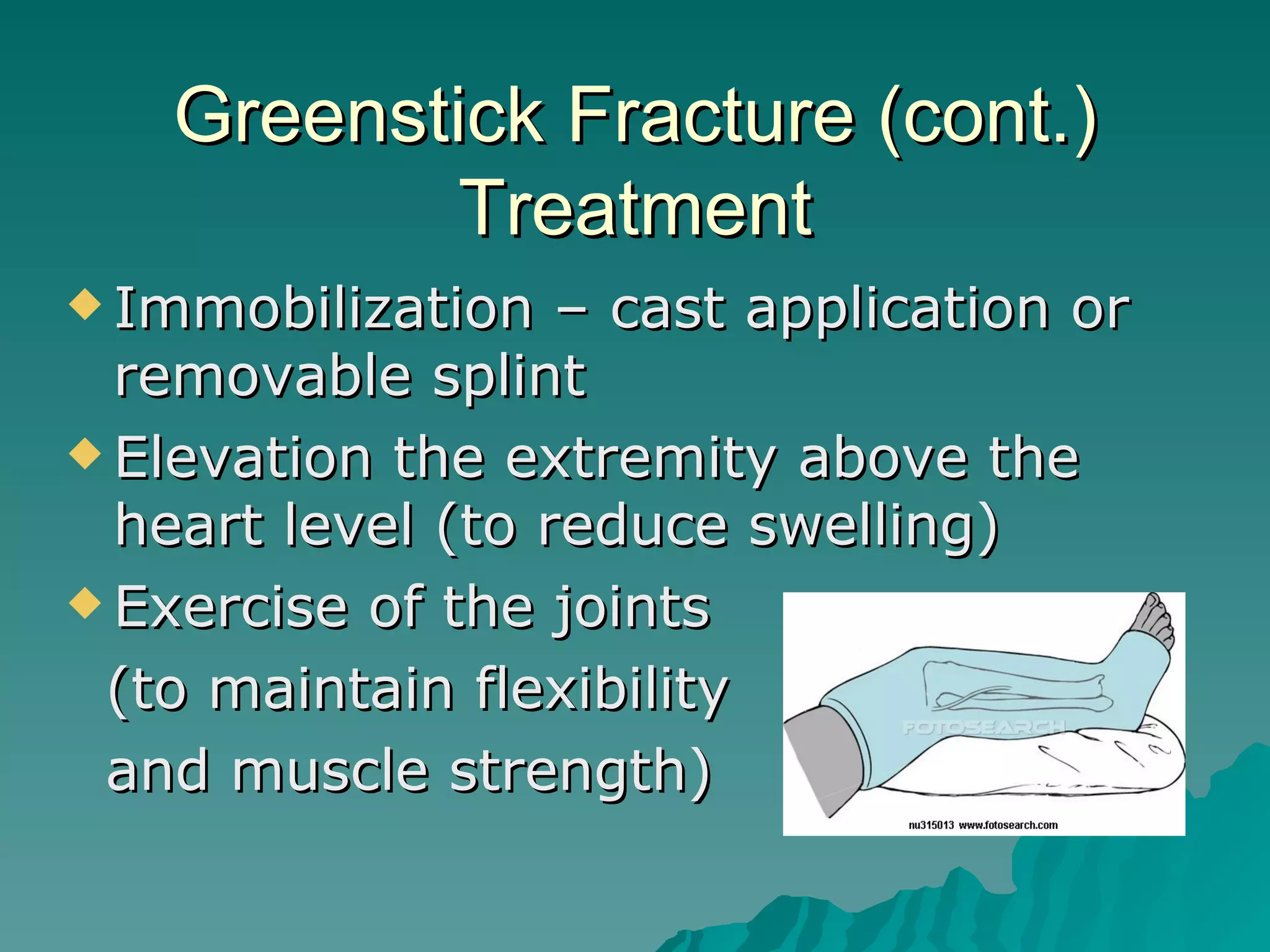 Compound Fracture Impacted Fracture Greenstick Fracture PPT