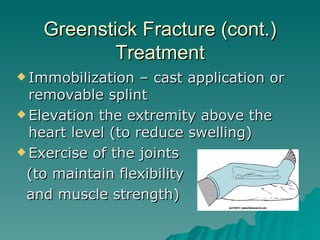 Compound Fracture, Impacted Fracture, Greenstick Fracture | PPT