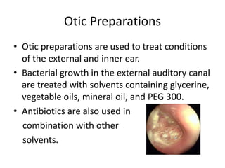Otic Preparations
• Otic preparations are used to treat conditions
  of the external and inner ear.
• Bacterial growth in the external auditory canal
  are treated with solvents containing glycerine,
  vegetable oils, mineral oil, and PEG 300.
• Antibiotics are also used in
  combination with other
  solvents.
 