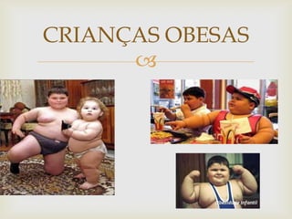 CRIANÇAS OBESAS
      
 