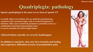 Quadriplegia: pathologyQuadriplegia: pathology
Spastic quadriplegia is the most severe form of spastic CP
It usually affects term infants who are small for gestational age,
consistent with a prenatal origin, such as cerebral dysgenesis or
infection. Other cases result from perinatal or postnatal events or a
combination of prenatal and perinatal causes
is seen in extremely low birth weight infants
Affected infants typically are severely handicapped
In addition to spasticity, they may have dystonia and feeding
and respiratory difficulties because of pseudobulbar palsy
Return to index
 