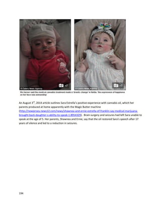 194
Sophie’stumorhassurpassedeverythingthatdoctorstolduswaspossiblewithchemoalone,and
we are onlyat month9 of a 13 monthchemoprotocol. Because of the amountof shrinkage we are seeing
we truly believe we’ll be able to quit chemo after her next set of scans in 2 months.
On topof the amazingshrinkage we have seen,Sophie hasalsocontinuedtogainweightandhas
a greatqualityof life despite havingchemoonce a weekwithshortbreaksfrom time to time.Herhair is
growing back, she is advancing developmentally, and despite the need for frequent blood transfusions
she is otherwise really happy and healthy. We truly,truly believe that we will completely get rid of this
tumor, and Sophie will not have to live with a mass in her brain for the rest of her life.
Because of the amazingresultswe are seeingnotonlywithourchild,butwithmanyotherchildren
whose familieswe are nowclose to, I am refocusingmy life on beingan advocate for treating pediatric
cancer with cannabis. I am seeingchildrengetsenthome todie whenchemoand radiationdidn’twork,
and cannabis completelyridding their bodies of tumors. It’s like watching miracles every day of my life,
and beinga part of thismovementhasbeenthe mostrewardingexperience of mylife!! Itell people that
Iam livingadreamthatwasspawnedfromanightmare.Iwentfromnotknowingifmychildwouldsurvive
to being a witness to the most beautiful of miracles. I thank God every day for giving us this miraculous
plant. Ijustpray thatour governmentwill soonopenitseyessoeveryone whoneedstouse thismedicine
can do so without fear of prosecution.
In the video below you will see the tumor from September 2013 on the left and June 2014 on
the right, as explained by the neurologist.
https://www.youtube.com/watch?v=tNdU06rEghI”
Sophie’s case has attracted the support of Stephen Amell,who plays Oliver Queen/Green Arrow in the
CW show Arrow (http://comicbook.com/blog/2014/07/07/stephen-amell-raffling-off-arrow-statues-for-
charity). Stephen raffled off Arrow statues to raise moneyfor the Ryan family. DC Comics steppedin to
provide more statues as well. As time of publishing, Stephen’s work has raised over $98,000.
 