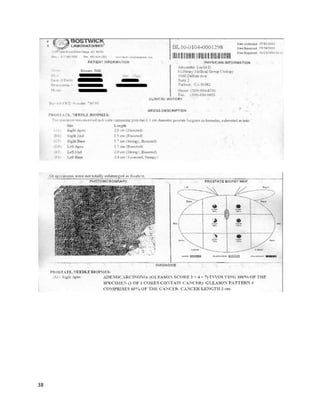 38
Coltynhascontinuedtodo verywell withcannabisashisprimarymedicationasof February2016. He
has evenwonat leastone majorawardfor hisactivism.
A videopostedonOctober5,2011 discussedthe storyof anelderlywomanwhoovercame
Stage IV cancerand lupuswithcannabisoil (http://www.youtube.com/watch?v=jxis8lqaEGE).InJanuary
2011, the woman(knownas“Granny”) wastoldshe had “days,weeksatthe most” to live,asher
conditionwasespecially taxing. Inadditiontothe cancer, she wasparalyzedfromthe leftside of her
face,startingfromthe jaw, to the waist. A compassionate strangerlearnedof herstoryand donated
cannabisoil to help.A litanyof improvementsimmediatelystarted afterGrannybeganthe treatment,
includingreductionof tumors,almostcompleteeliminationof chronic pain,ceasingof constant
vomiting,andremarkable concurrentimprovementsforlupusandfibromyalgia. Grannyforewent
chemotherapyandsurgeryforthispath,and stronglybelieves,basedonthe poorprognosisfrom
doctorsand the state she wasin,that if not for cannabisoil she wouldbe dead.
Cannabisoil hasprovento be effectiveagainstevenlong-standingchronicpain
(http://www.youtube.com/watch?v=gu5VNQHxKkU).A videoreleasedinOctober2011 featuresTomas
Harner,who for30 years enduredbackpainas a resultof accidents. Inthe last 10 years,he saidhis
 