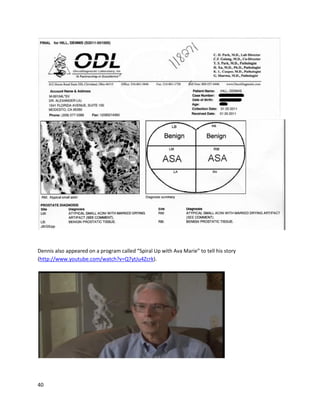 40
Aamannhas treatedanddocumentedawide varietyof conditions,includingallergies
(http://www.youtube.com/watch?v=V0fgTIorzXI),ADD
(http://www.youtube.com/watch?v=C4ljMHUW4uI),neuropathy
(http://www.youtube.com/watch?v=p4Y0CW10RTg),insomnia
(http://www.youtube.com/watch?v=n1odhWwHSps),cyclical vomitingsyndrome
(http://www.youtube.com/watch?v=3tVtUf1hTQs), lymedisease
(http://www.youtube.com/watch?v=d_HAOkPSzgw)andmore. A particularlyintense case describesa
patient’sexperience withtrigeminal neuralgia,aconditionsoterrible itisnicknamed“suicidedisease.”
TN isa neuropathicdisorderthatinvolvesepisodesof intense,stabbingpaintothe face. Aamann
providedcannabis oil toa TN patientand observedthatit worked remarkablywell,withthe patient
reportingzeroproblems (http://www.youtube.com/watch?v=S495AUPbka0).
Before movingforward,itisimportanttohighlightthe trendregardingcannabisoilandpain.
Currently,the primarytreatmentforpainisopiates. Manypatientshave reportedthatnotonlyare
opiatesineffectiveoverthe long-term,buttheycause immense physical discomfort,cloudinessof the
mind,and otherphysical complications.Somanypatientshave stronglyinsisted thatcannabisoil isfar
more effectivethanopiateswithnone of the side effects. Theyfeel cannabinoidtreatment attacksthe
roots of theirpain,ratherthan providingamere numbingeffect.Sucheffectsare difficulttoobjectively
measure because theyare entirelysubjective,butthisremarkablystrongtrendissomethingthatcannot
be ignored.
A January2012 videofeaturingthree patients,Mike Stone, Tom,andJeff,illustratedthe
benefitsof cannabisoil formultiplesclerosis,rheumatoidarthritis,andmesothelioma
(http://www.youtube.com/watch?v=V-uGtEHzZUE).Mike hadbeendiagnosedwithrelapsing-remitting
multiple sclerosis17 yearspriorto the video’sfilming. Tocombatthe disease,he wasprescribedalitany
of drugs,whichcreatedmanyunpleasantside effects,includingsuicidalthoughts. AfterseeingRun From
the Cure,Mike decidedtotry a 90-day cannabisoil treatmentprogram. He concurrentlyceased all use of
pharmaceuticals. He foundthe oil toworkveryeffectively,whileeliminating the remainingside effects
fromprior pharmaceutical use.
 