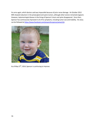 79
A furtherarticle aboutthe cannabisextractsituationinSouthAfricaopenedwithaquote fromLindsey
Martin, a Cape Town motherwhotreatedherself for coloncancerwithoil
(http://www.iol.co.za/news/politics/clamour-for-medical-marijuana-1.1651195).“There is nodoubt
aboutit. My aggressive cancerisgone…the same cancer that was supposedtokill me inmonths.Iam
alive todaybecause of cannabisoil.” Anarticle onChrisBeatCancer.comdescribedLindsey'scase inmore
detail (http://www.chrisbeatcancer.com/lindsey-cures-colon-cancer-with-cannabis-in-48-days).
Lindsey,aresidentof Cape Town,SouthAfrica,wasdiagnosedwithcanceronSeptember7,2011. A few
weekslater,itwasdeterminedtobe Stage IIIcoloncancer, withmetastasestolymphnodesandone
spoton her liver.A tumorinLindsey'scolonwassurgicallyremoved,andshe wassubsequently
scheduledfor6monthsof chemotherapyfor30 weeks.
The chemotherapystartedonOctober14, 2011. It took a great toll onher;Lindseysaidit
"suckedthe life out of me."The onlytimesshe feltbetterwaswhen friendsbroughtaroundcannabis
and she wasable to smoke some.Itenabledhertoenjoyfood,sleepbetter,andfeelanoverall senseof
wellness.Lindseytoldherdoctor,whoinstructedhertotake inas much as she could.On February15,
2012, halfwaythroughthe chemotherapysessions,Lindseywentinfora CT scan. Inadditionto
chemotherapy,Lindseywaseatinganorganicvegetariandiet,berrysmoothies,brownrice,greenfoods,
and supplementslike VitaminC,greenandhemppowders,spirulina,milkthistle,andsodium
bicarbonate.Despite everything,herconditionhadworsened.She hadfourlesionsonherliver,a2.8cm
stone inher gall bladder,anda cyston her kidney,all of whichhadbeencausedbythe chemotherapy.
At thispoint,Lindseydecided tostopchemotherapy.
Afterhearingaboutthe potential of cannabisoil totreatcancer frompeople onFacebook,
Lindseydecidedtobeginusingcannabistherapy,andwasable toquicklyfindcannabisoil inher
community.She beganwithsmall doses,and ultimatelyconsumed18grams of cannabisoil in46 days.
She continuedeatingahealthydietandtakinggreens-richsupplements.OnMarch 28, 2012, Lindsey
underwentarange of tests,thenmetwithfourdoctorswhodeclaredshe hadno signof any cancer in
herbody.Lindseystated, "Lastly,Ihave tosay that my cancer diagnosiswasatrue blessing…it
facilitatedachange withinme oneverylevel –emotionally,physically,mentallyandspiritually…it
formedanunbreakable bondof love andsupportwithmyhusband.I’ve become brave andconfidentin
my ownpowerto heal myself…andthisistrulythe biggestblessing…andIreallywanttohelpinspire
othersto do the same…"
Unfortunately,LindseyMartinpassedonMay 28, 2014, from complicationscausedbybowel
surgery.She remainedcancer-free atthe time of herdeath,andthe surgerywasunrelatedtocancer.
The author and manyfriendswere shockedthatLindseywouldpassinthismannerafterfightingsohard
to successfullybeatcoloncancer.Herspiritlivesoninthe people she helpedandinspired.
 