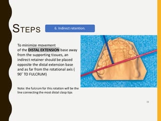 Tissue Ward Rotation Rpd Comprehensive_RPD_Design_Presentation.pdf