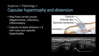 Superior > Pathology >
Capsular hypertrophy and distension
• May have varied causes
(degenerative, infectious,
inflammatory
• Capsule to bone distance < 3
mm rules out capsular
hypertrophy
 