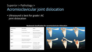 Superior > Pathology >
Acromioclavicular joint dislocation
• Ultrasound is best for grade I AC
joint dislocation
Rockwood classification for acromioclavicular dislocation
 