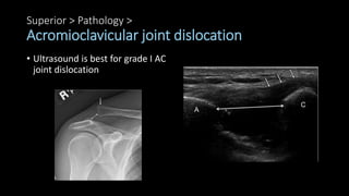 Superior > Pathology >
Acromioclavicular joint dislocation
• Ultrasound is best for grade I AC
joint dislocation
 