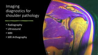 Imaging
diagnostics for
shoulder pathology
• Radiography
• Ultrasound
• MRI
• MR Arthography
 