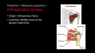 Posterior > Relevant anatomy >
Infraspinatus tendon
• Origin: Infraspinatus fossa
• Insertion: Middle facet of the
greater tuberosity
 