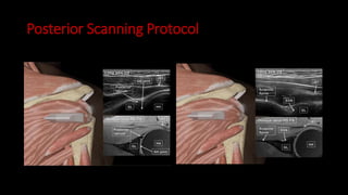 Posterior Scanning Protocol
 