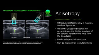 Anisotropy
• Ultrasound artifact notably in muscles,
tendons, ligaments
• When the ultrasound beam is not
perpendicular, the fibrillar structure of
the tendons reflect sound away from
the transducer
• Produces hypoechoic structure
• May be mistaken for tears, tendinosis
 