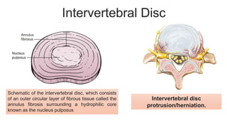 Compression Fracture of Vertebrae Lumbar IV-V.pptx