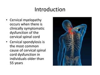 Introduction
• Cervical myelopathy
occurs when there is
clinically symptomatic
dysfunction of the
cervical spinal cord
• Cervical spondylosis is
the most common
cause of cervical spinal
cord dysfunction in
individuals older than
55 years
 