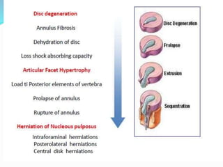 Compressive myelopathy - Etiology, Pathogenesis, Clinical Features ...