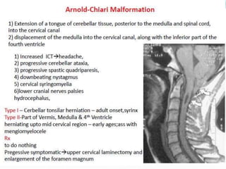 Compressive myelopathy - Etiology, Pathogenesis, Clinical Features ...